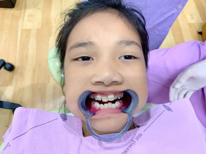 Braces Girl Video Viral at Thomas Reiser blog How to paint a wall